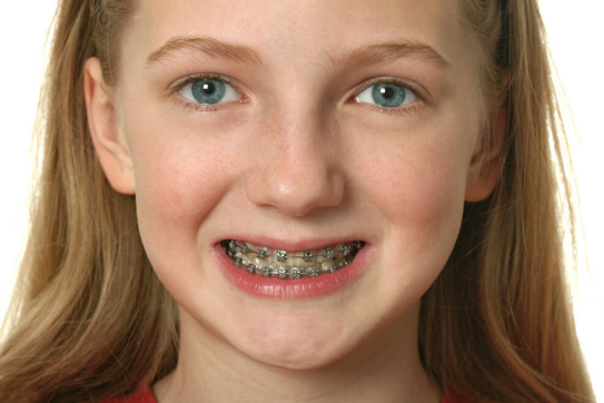 Children with orthodontic treat